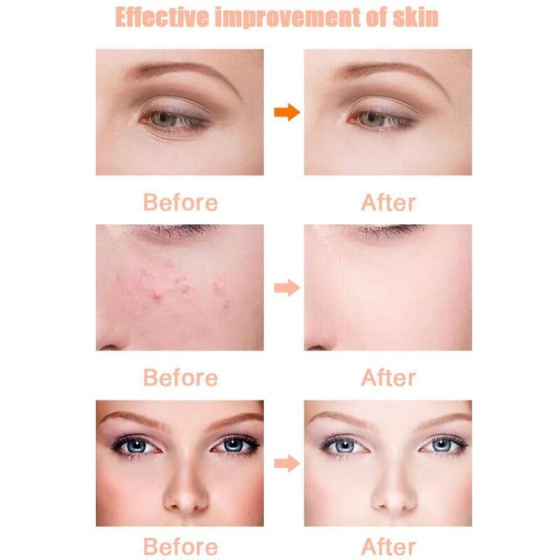 3 Color LED Photon Mask - Manufacturer Wholesale - Home Use Face Facial Beauty Skin Care