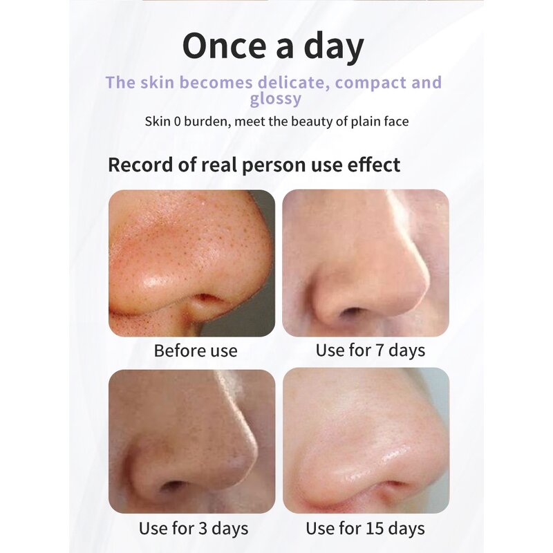 Small Bubble Blackhead Remover - Rechargeable - Vacuum Water Bubble Pore Facial Cleaner