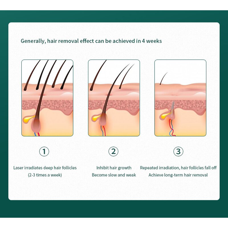 Laser Hair Removal Device Manufacturer - Novel Portable Electric Cooling Ice Epilator