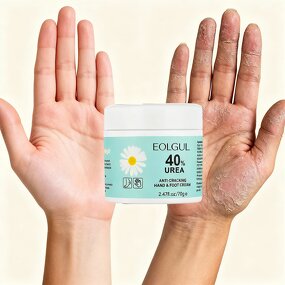 Foot Cream Manufacturer - for Cracked Heels Exfoliating Anti Crack Whitening with Urea