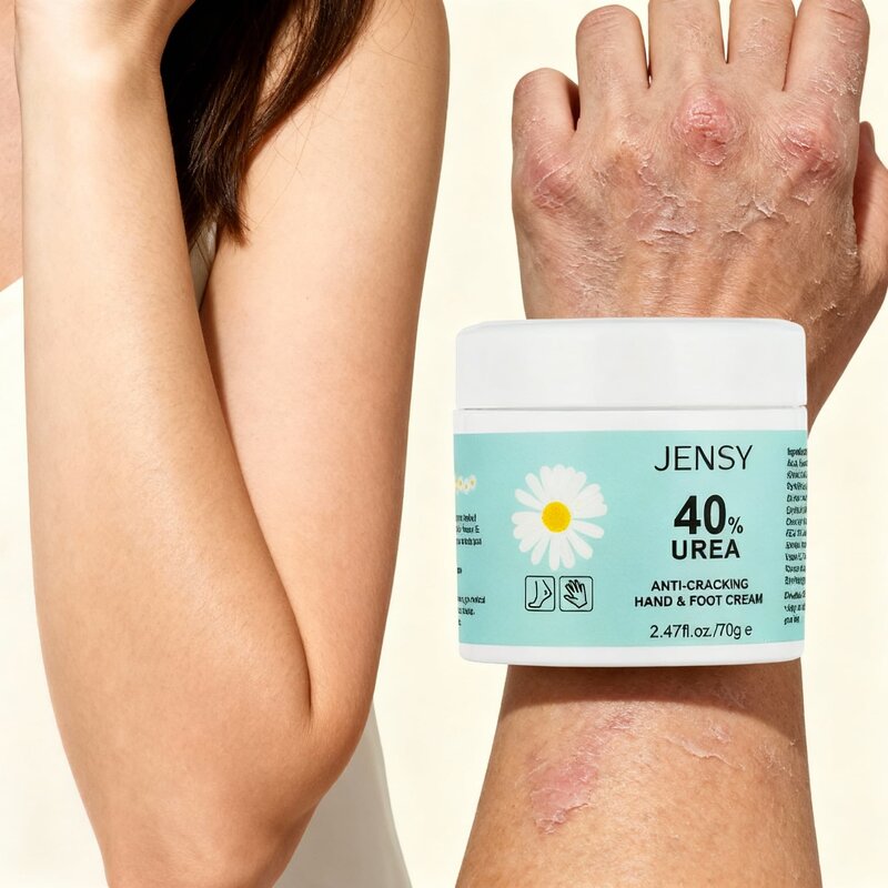 Foot Cream Manufacturer - for Cracked Heels Exfoliating Anti Crack Whitening with Urea