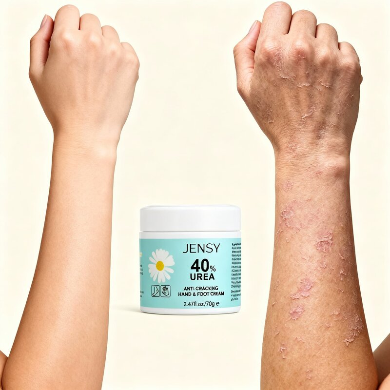 Foot Cream Manufacturer - for Cracked Heels Exfoliating Anti Crack Whitening with Urea