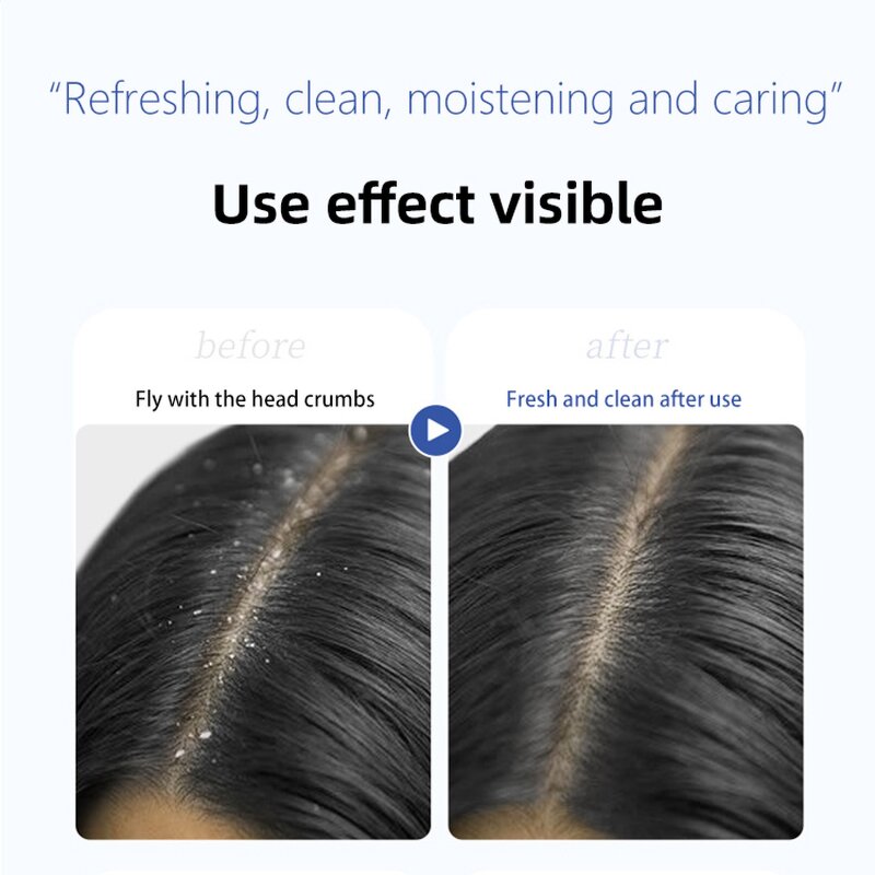 Anti-Dandruff Shampoo Manufacturer - Selenium Disulfide Oil Control Volumizing