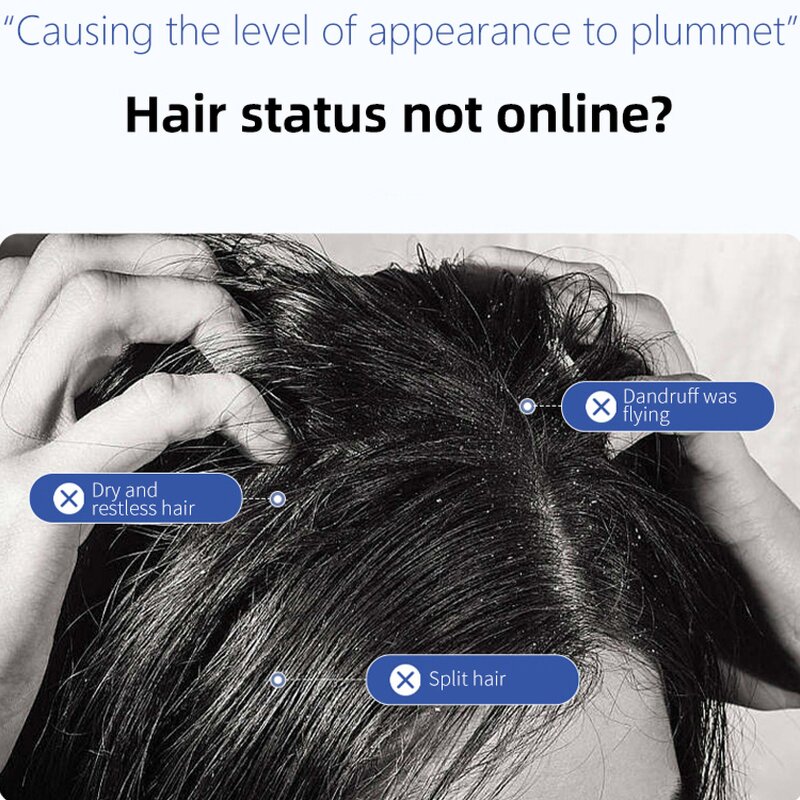 Anti-Dandruff Shampoo Manufacturer - Selenium Disulfide Oil Control Volumizing