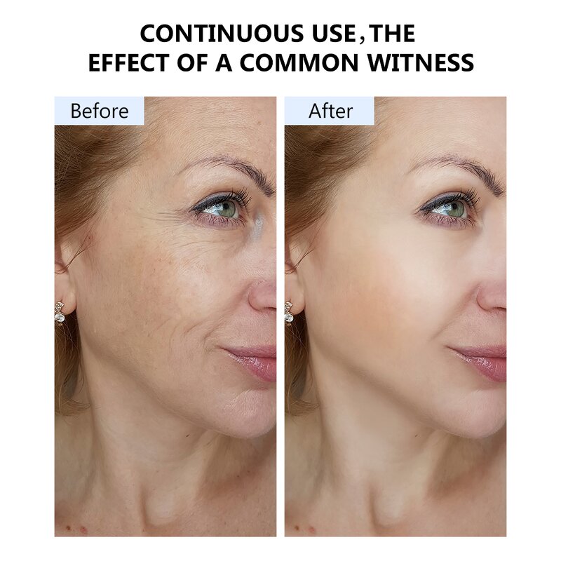 Face Serum Manufacturer - Maycheer Niacinamide 35ml Anti-Wrinkle Repair Barrier