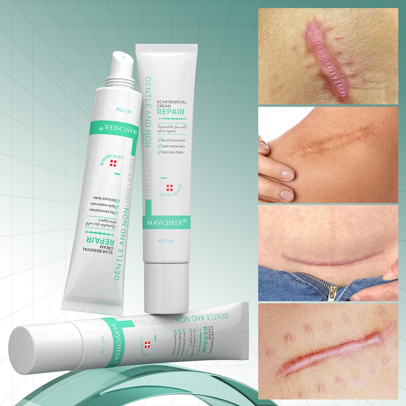 Scar Repair Cream Manufacturer - Maycheer 15ml Fade Body Scar Gel Factory Price