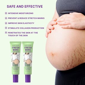 Stretch Mark Cream Manufacturer - for Pregnancy Belly Obesity Scars Moisturizing