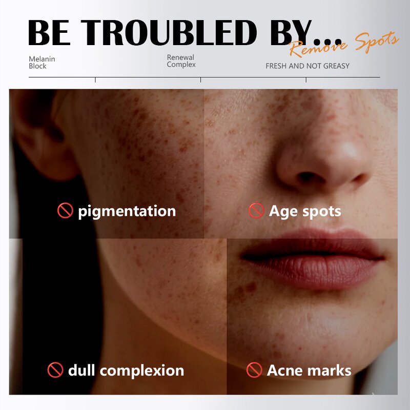 Face Serum Manufacturer - Maycheer 35ml Niacinamide Anti-aging Anti-blemish