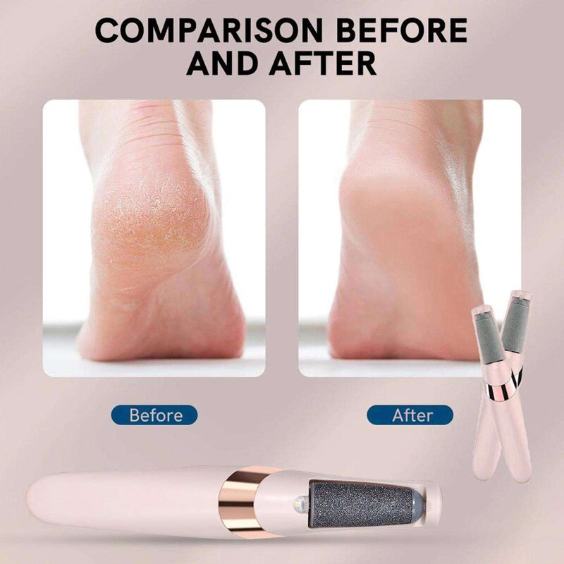 Electric Foot File Manufacturer - Hot Pedicure Remove Dead Skin Rechargeable Callus Remover
