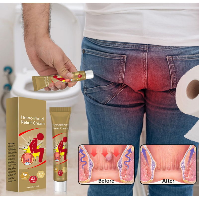 Ointment - Manufacturer Natural Herbal Hemorrhoidal Piles Removal Balm Cream