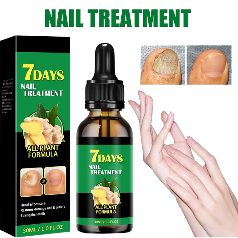Serum - Manufacturer Herbal Anti Fungal Nail Repair Onychomycosis Feet Care