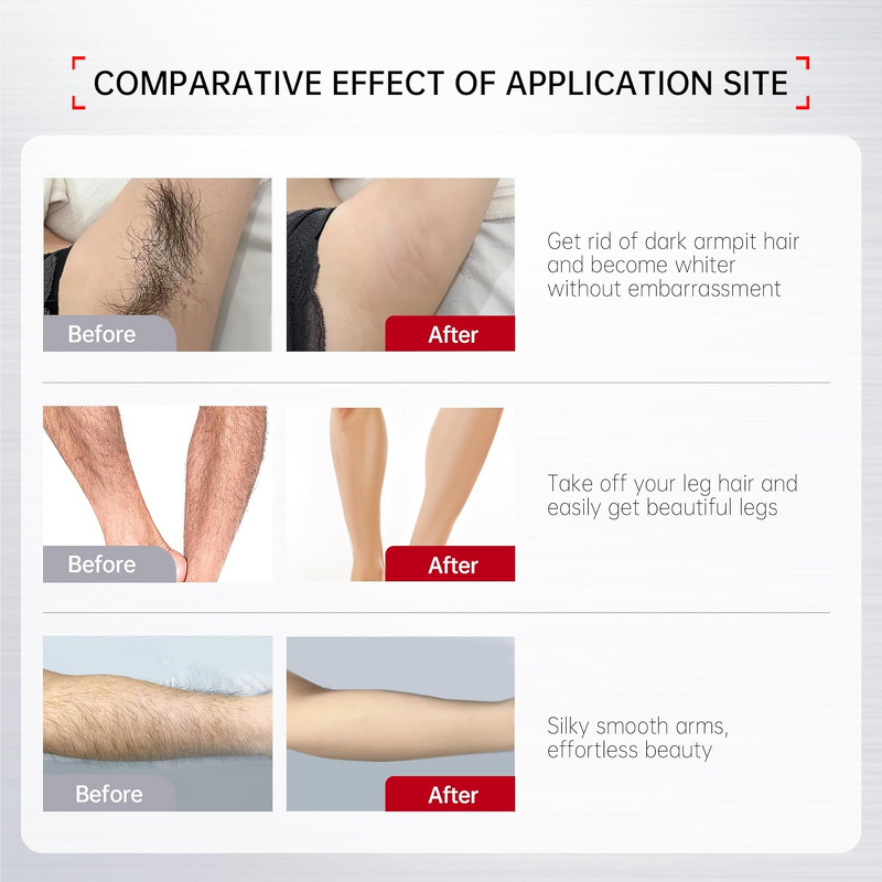 Depilatory Cream - Manufacturer 2025 Wholesale Gentle Private Part Hair Removal