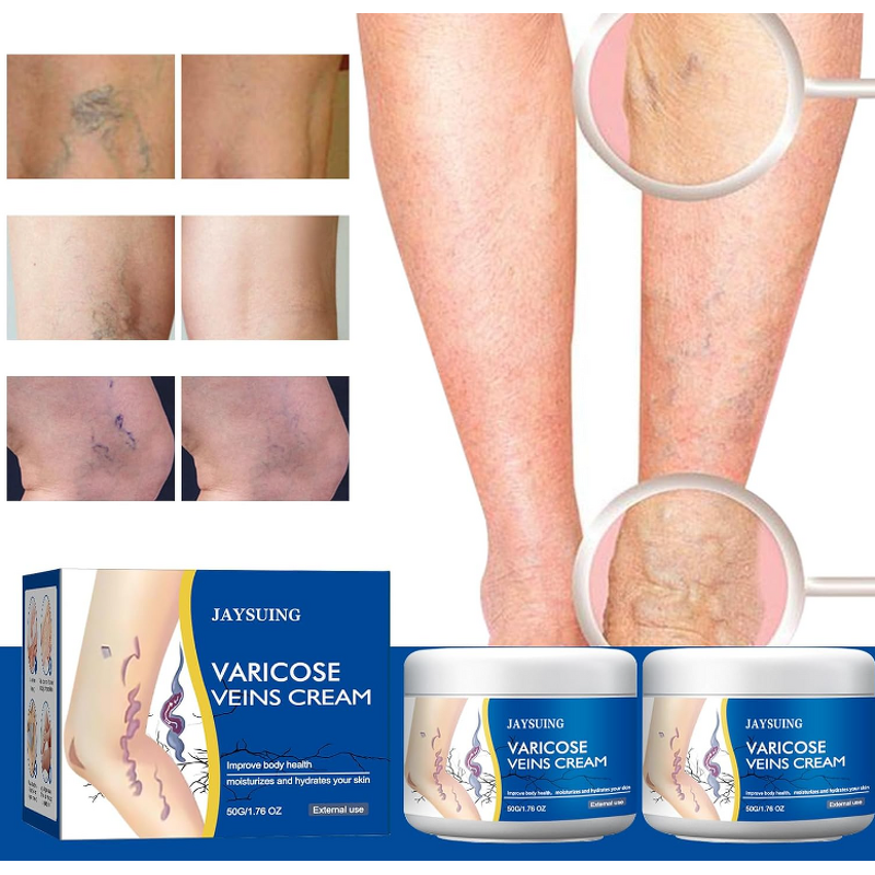 Ointment - Manufacturer Wholesale Varicocele Vasculitis Varicose Vein Cream