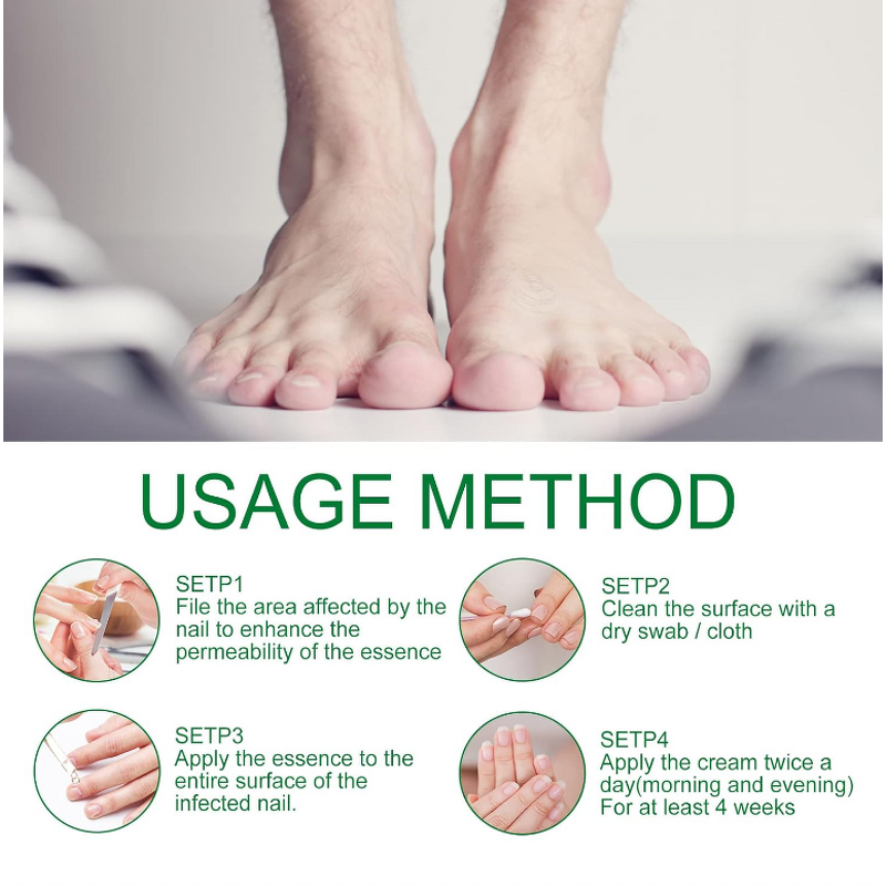 Serum - Manufacturer Herbal Anti Fungal Nail Repair Onychomycosis Feet Care