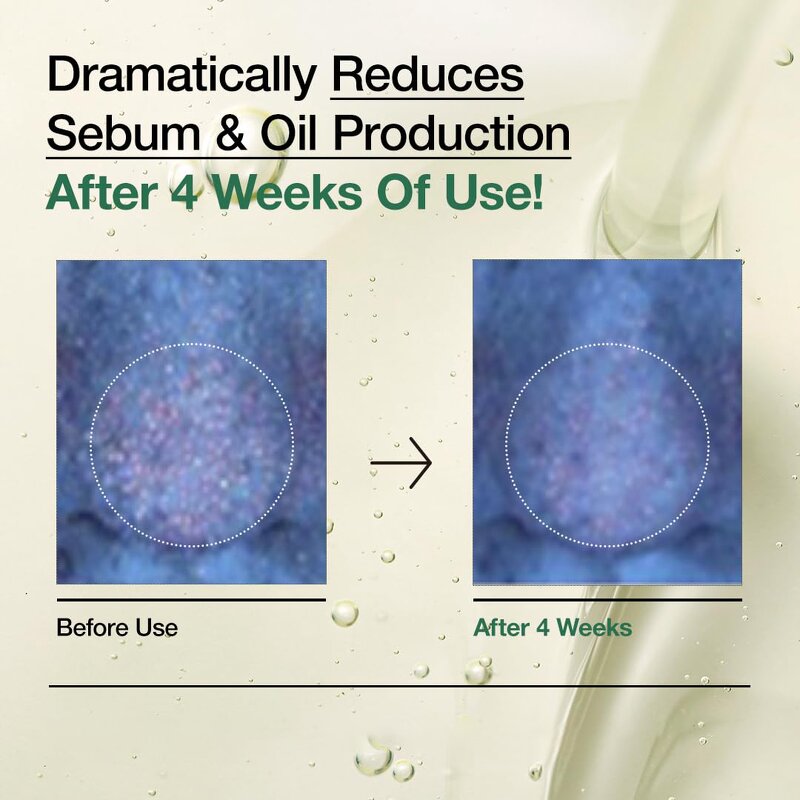 Pore Cleansing Oil Manufacturer - Organic Heartleaf with Spray Form