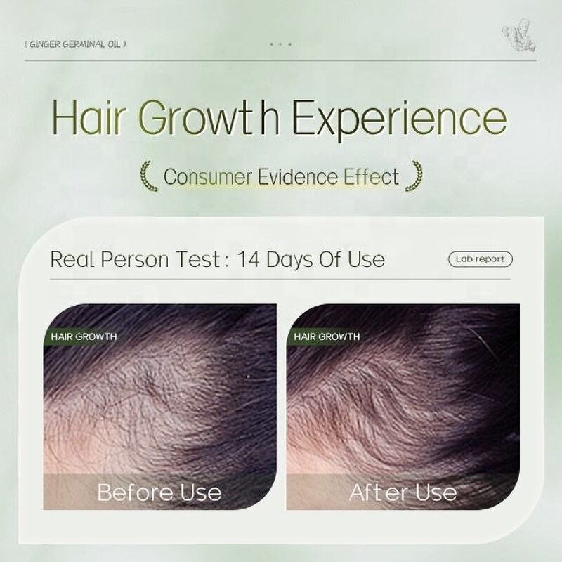 Hair Growth Oil Manufacturer - Custom Organic with Peppermint