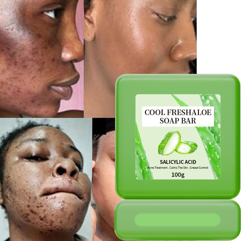 Facial Soap Manufacturer - with Shea Butter and Aloe Vera Vitamin E