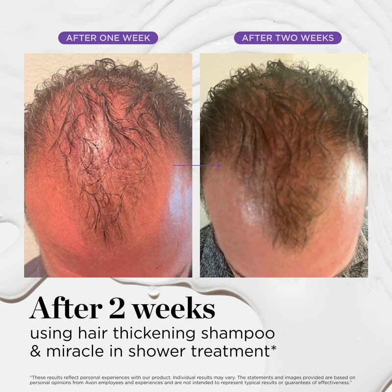 Hair Growth Oil Serum Manufacturer - OEM Wholesale 100% Natural Herbal