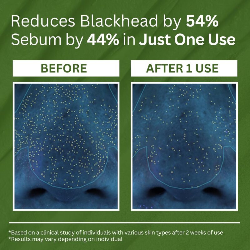 Bubble Mask Manufacturer - Holy Basil Carbonated for Pore Cleansing