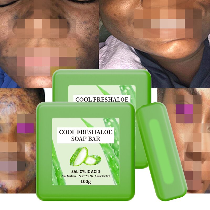 Facial Soap Manufacturer - with Shea Butter and Aloe Vera Vitamin E