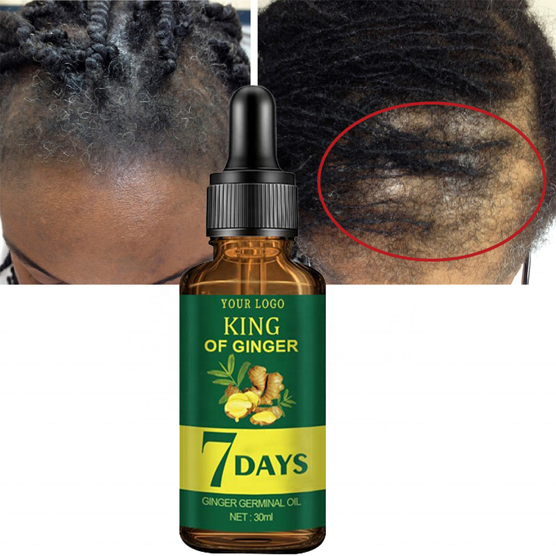 Hair Growth Oil Manufacturer - Custom Organic with Peppermint