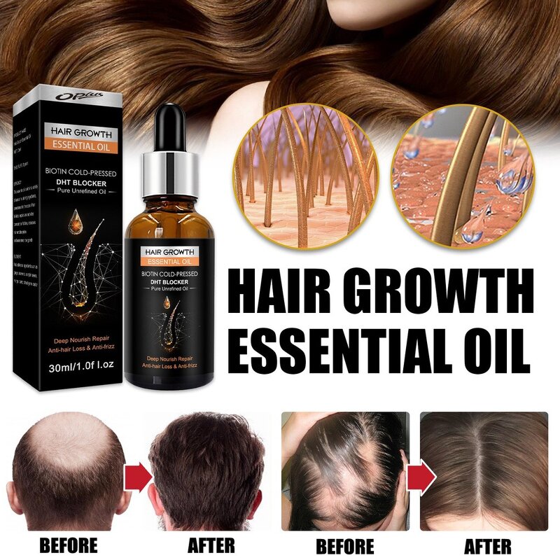 Men's Hair Growth Oil Manufacturer - with Ginger Peppermint & OEM