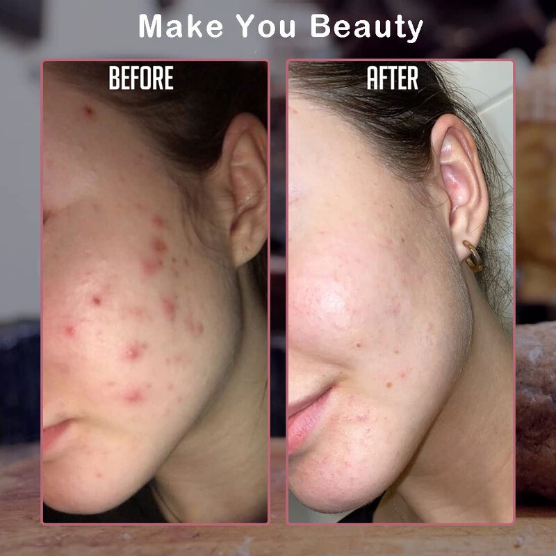 African Black Soap Manufacturer - Private Label with Chamomile for Body Face