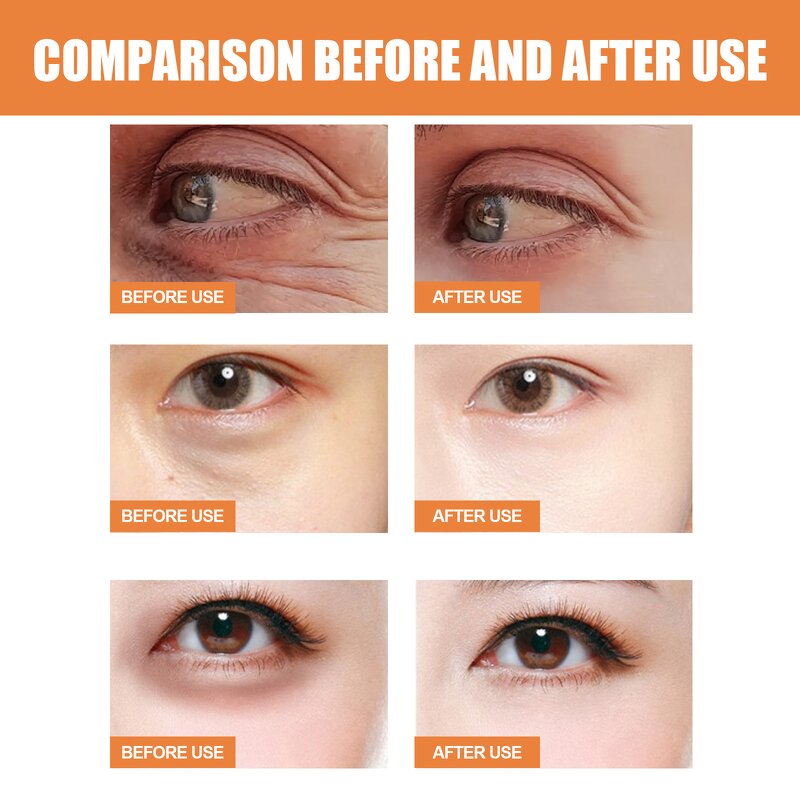 Eye Cream - Manufacturer Vitamin C Reduces Eye Bags Fine Lines Tightens Moisturizes