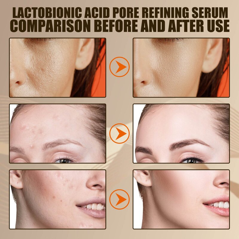 Serum - Manufacturer K.Y Lactose Acid Pore Reducing Facial Serum