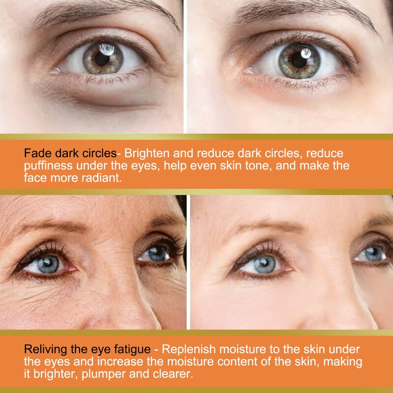 Eye Cream - Manufacturer Vitamin C Reduces Eye Bags Fine Lines Tightens Moisturizes