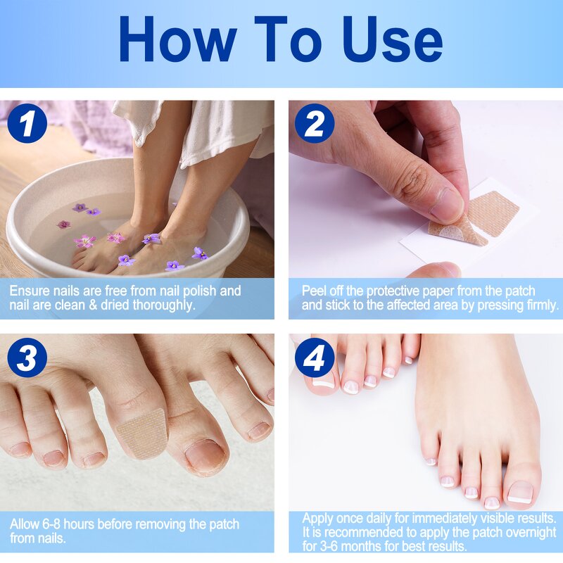 Nail Repair Patches - Manufacturer Multi Purpose Anti Fungal Correction Sticker