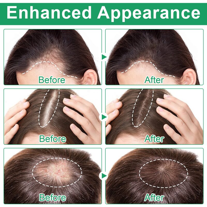 Hair Growth Serum - Manufacturer 20ml No-Rinse Rosemary Biotin Anti Hair Loss