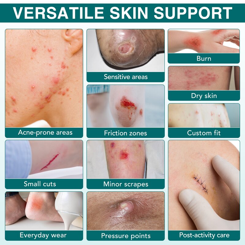 Hydrocolloid Bandages - Manufacturer Flexible Waterproof Medical Wound Care