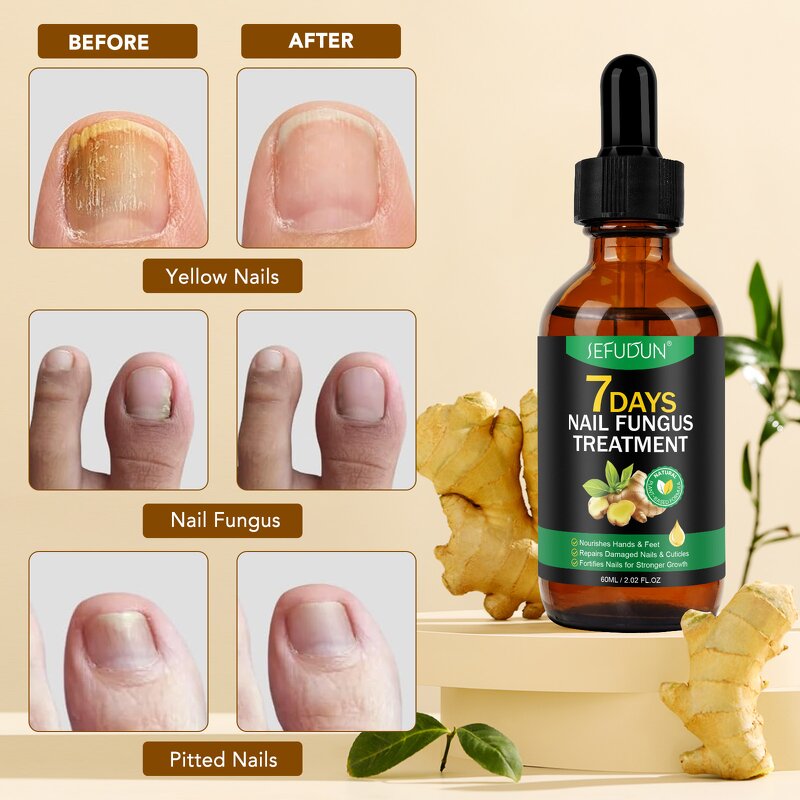 Nail Repair Oil - Manufacturer Private Label 60ml Ginger 7 Days Fungal Growth