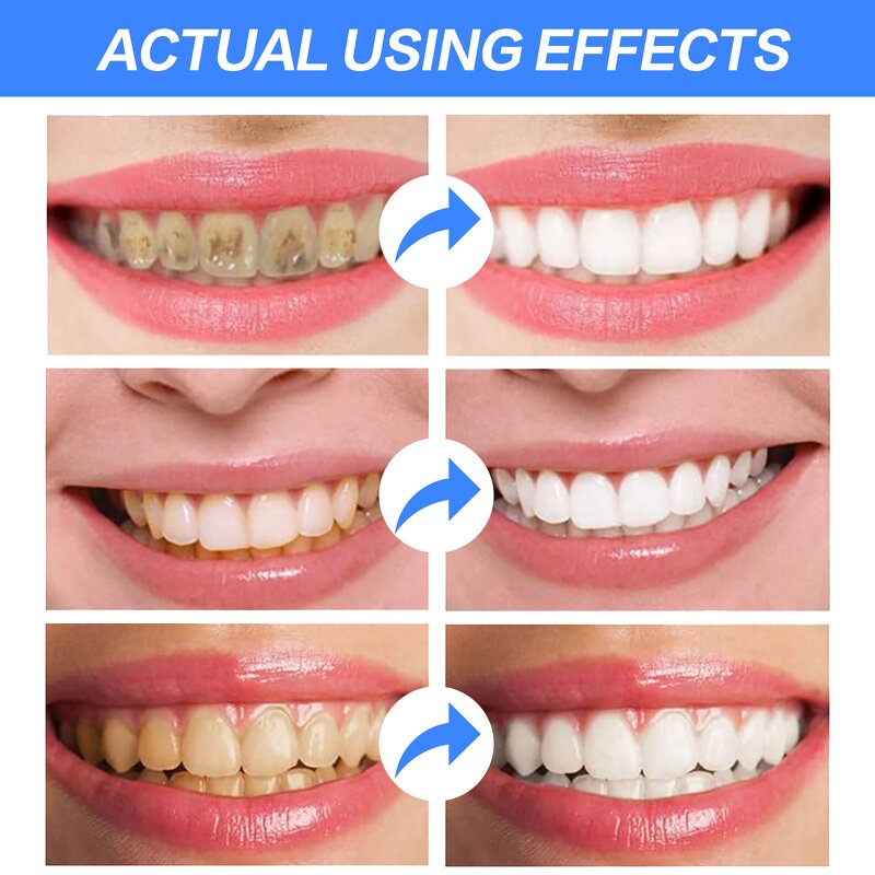 Soda Toothpaste - Manufacturer Fruit Flavor Stain Removal Oral Healthy