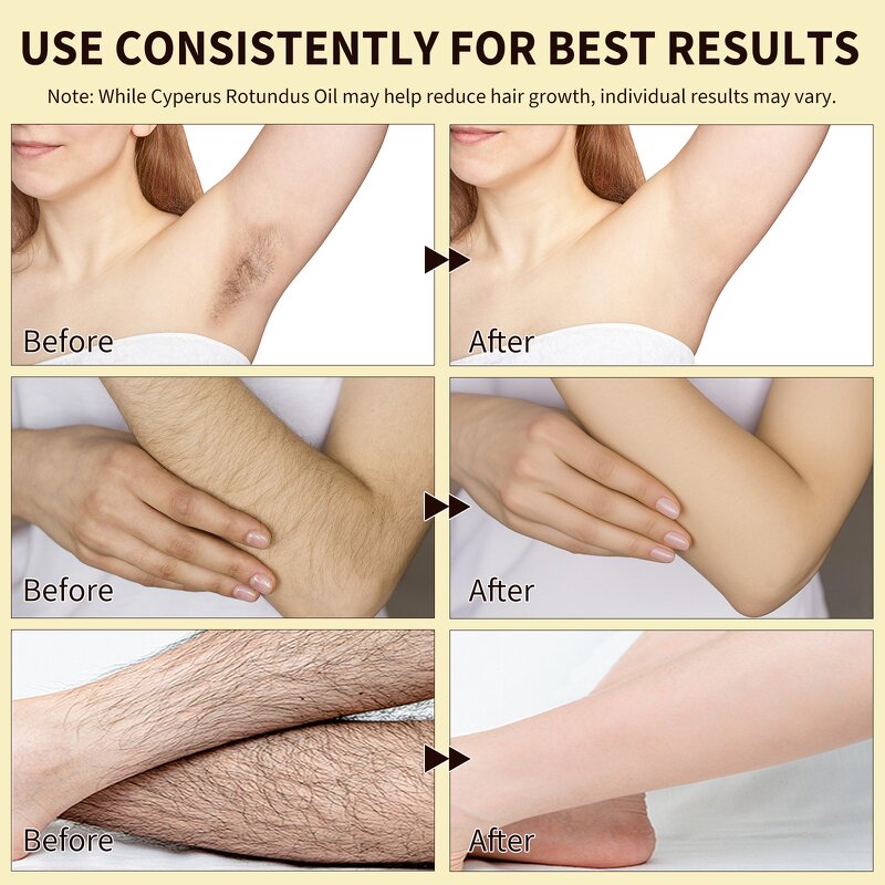 Cyperus Oil - Manufacturer 60ml Vegan Reduce Unwanted Hair Growth Skin