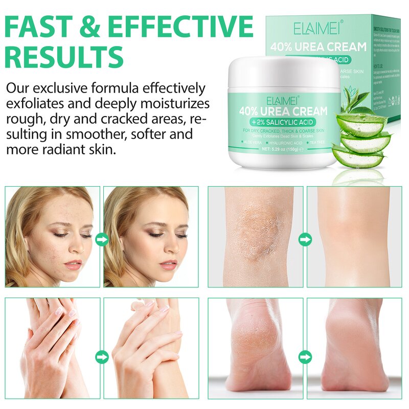 Urea Cream - Manufacturer 150g 40% Urea 2% Salicylic Acid Foot Hand Hydration