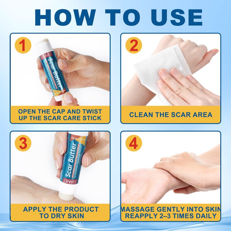 Scar Removal Cream - Manufacturer Private Label 20g Cocoa Butter Silicone Scar