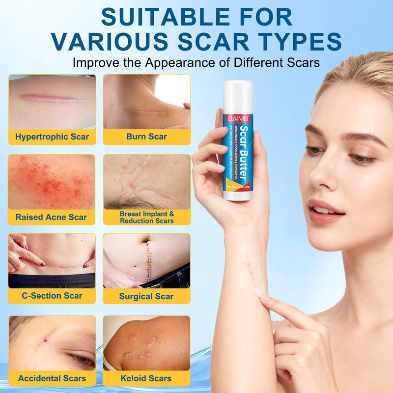 Scar Removal Cream - Manufacturer Private Label 20g Cocoa Butter Silicone Scar
