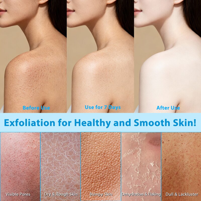 AHA BHA Body Stick - Manufacturer Private Label 75g 7% AHA 0.5% BHA Rough Areas