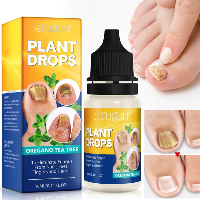 Nail Fungus Drops - Manufacturer 10ML Oregano Tea Tree Finger Toenail Repair
