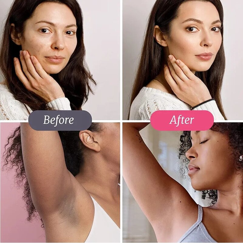 Skin Lightening Tea - Manufacturer OEM/ODM/OBM Natural Herbs Glow Dark Skin