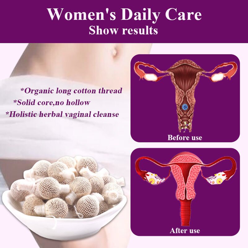 Yoni Pearls Manufacturer - Vacuum Packaging Womb Detox & Original Chinese