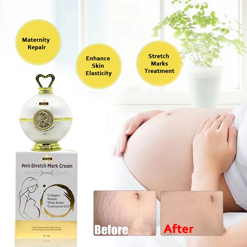 5D Gluta Stretch Mark Cream - Manufacturer Anti Reduce Scar Massage Fast Results
