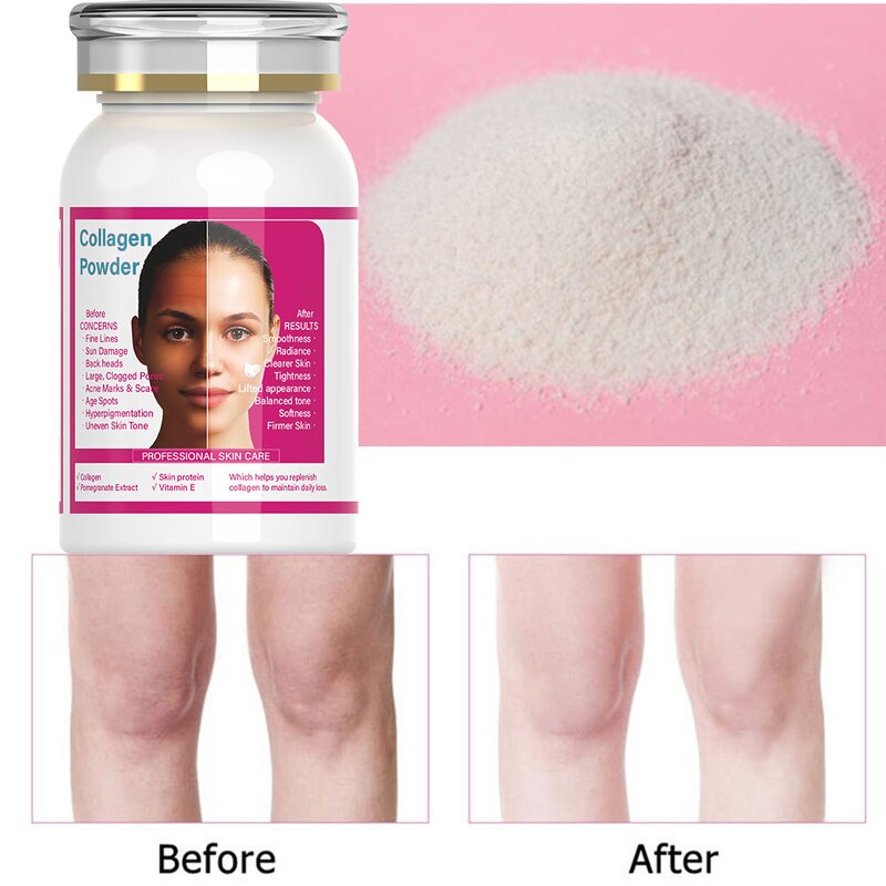 Whitening Powder - Manufacturer Kojic Acid Collagen Gluta Vitamin C Mix Lotion Serum