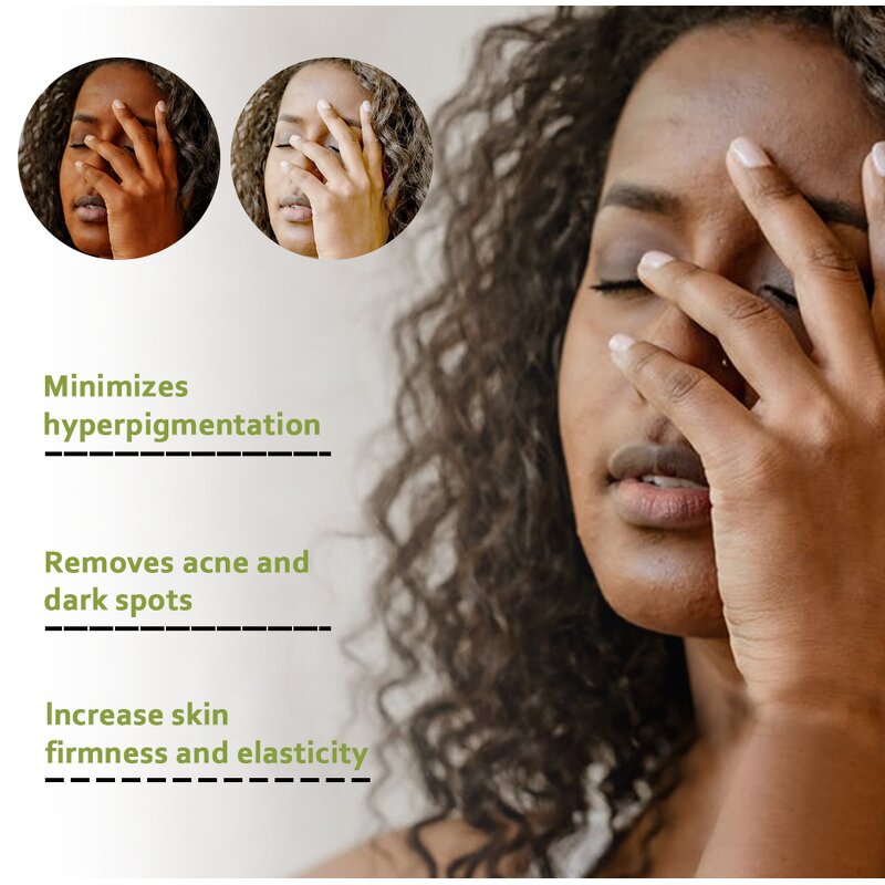 Glutathione Capsules - Manufacturer Skin Whitening Black Spot Remover Bleaching Pills