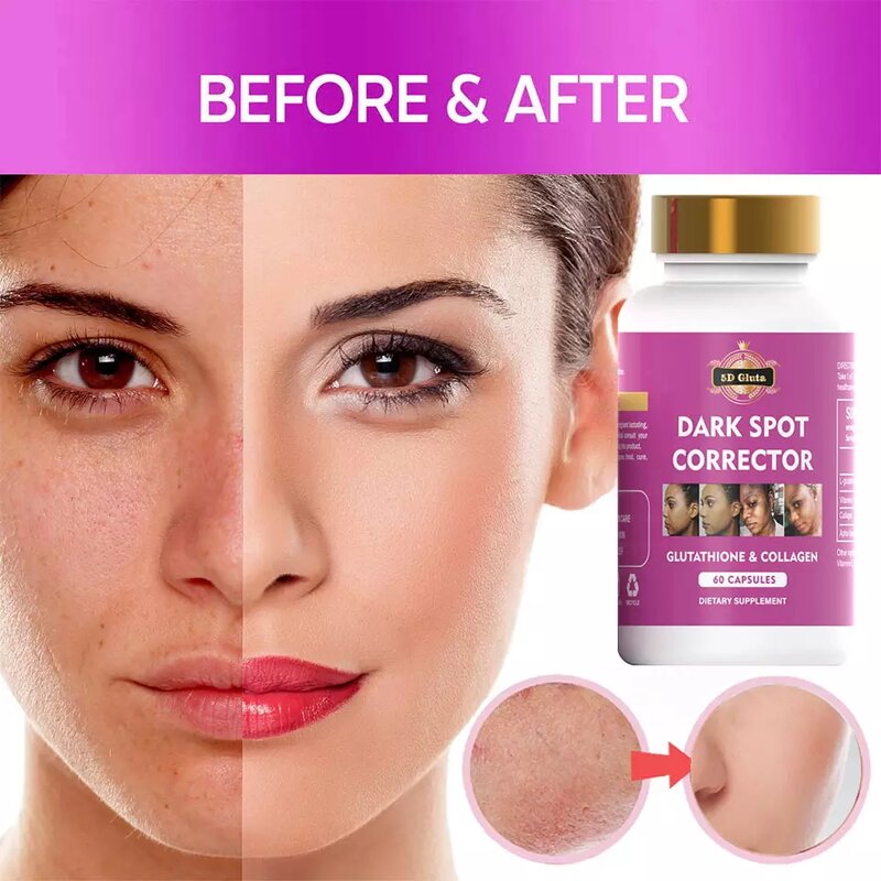 5D Gluta Capsules - Manufacturer OEM Dark Spot Corrector Vitamin E Remove Melanin