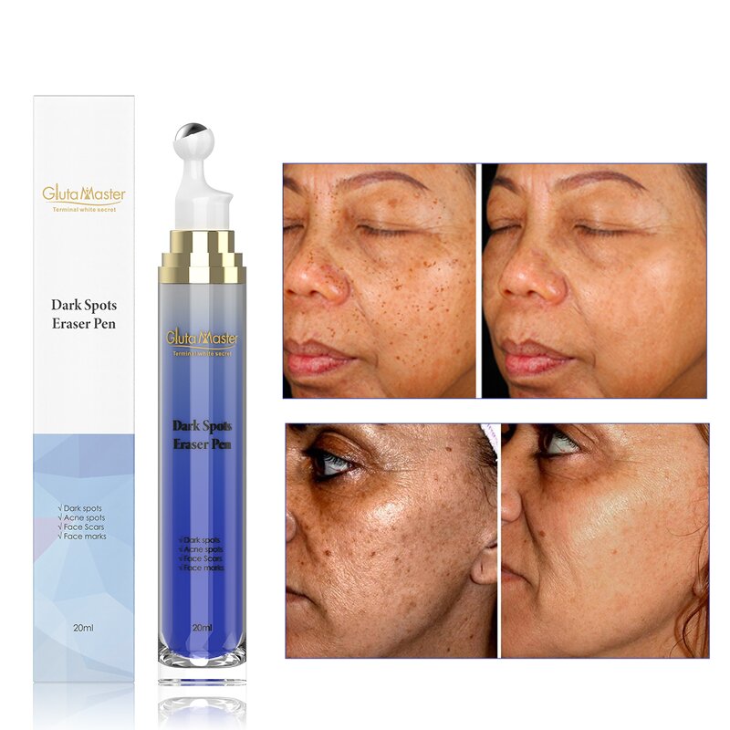 5D Gluta Roller Pen - Manufacturer 20ml Lightening Dark Knuckles Elbow Knee Toes