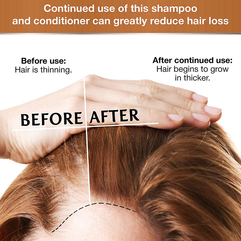 5D Gluta Hair Set - Manufacturer Shampoo Conditioner Growth Oil Peppermint Hemp