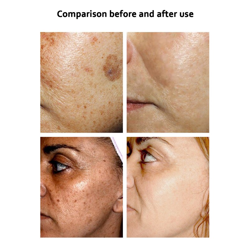 Collage Cream - Manufacturer Natural White Extra Blanchissant Eliminates Dark Spots